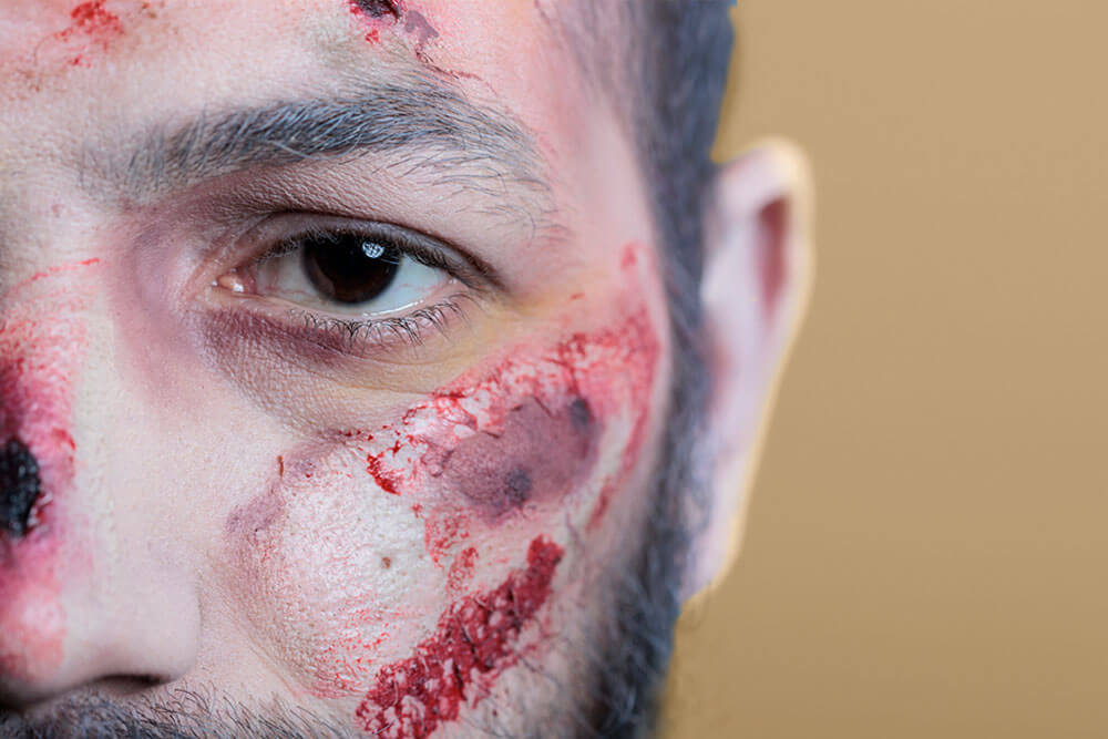 criminal law aggravated assault